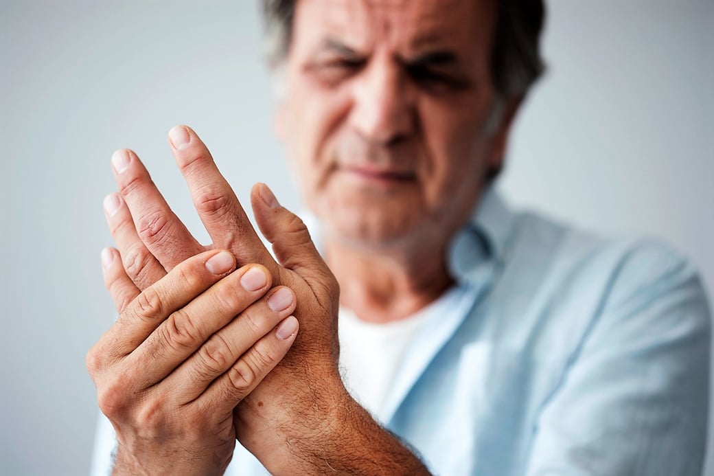 Senior with Arthritis Pain in Hand